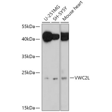 VWC2L Rabbit Polyclonal Antibody