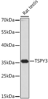 TSPY3 Rabbit Polyclonal Antibody