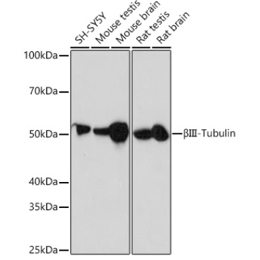 BetaIII-Tubulin Rabbit Monoclonal Antibody