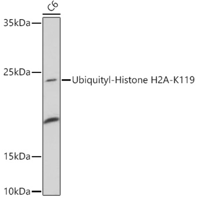 Ubiquityl-Histone H2A-K119 Rabbit Polyclonal Antibody