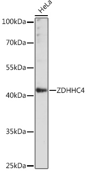ZDHHC4 Rabbit Polyclonal Antibody