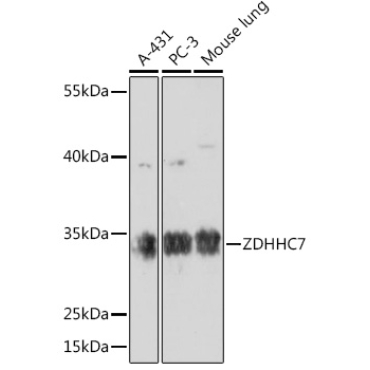 ZDHHC7 Rabbit Polyclonal Antibody
