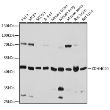 ZDHHC20 Rabbit Polyclonal Antibody