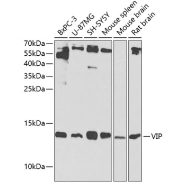VIP Rabbit Polyclonal Antibody