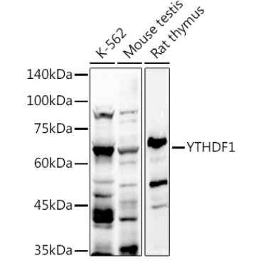 YTHDF1 Rabbit Polyclonal Antibody