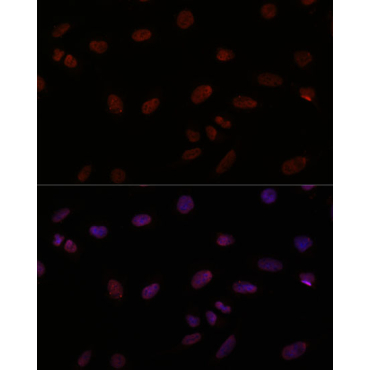 TTF1 Rabbit Polyclonal Antibody