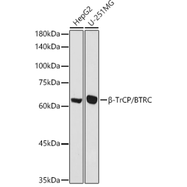 Beta-TrCP/BTRC Rabbit Polyclonal Antibody