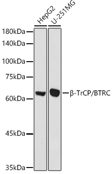 Beta-TrCP/BTRC Rabbit Polyclonal Antibody