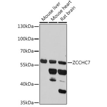 ZCCHC7 Rabbit Polyclonal Antibody