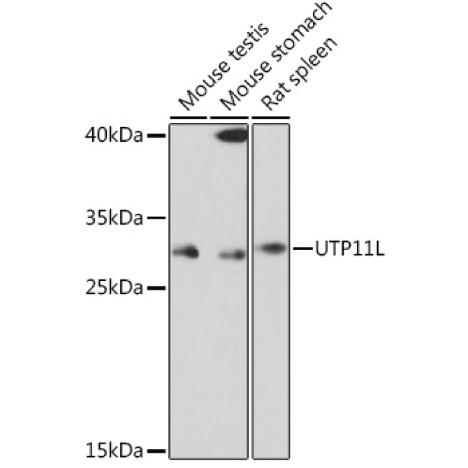 UTP11L Rabbit Polyclonal Antibody