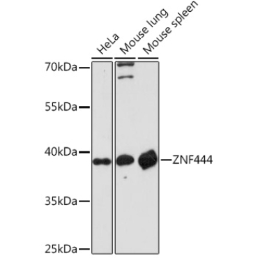 ZNF444 Rabbit Polyclonal Antibody