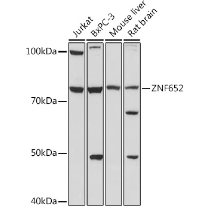 ZNF652 Rabbit Polyclonal Antibody