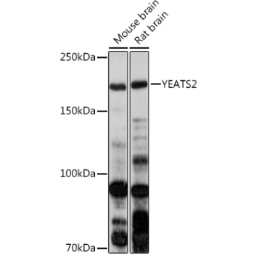 YEATS2 Rabbit Polyclonal Antibody