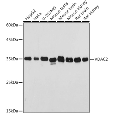 VDAC2 Rabbit Polyclonal Antibody