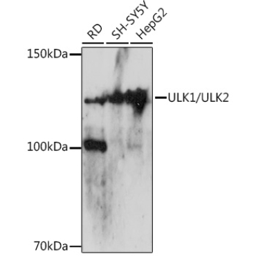 ULK1/ULK2 Rabbit Polyclonal Antibody