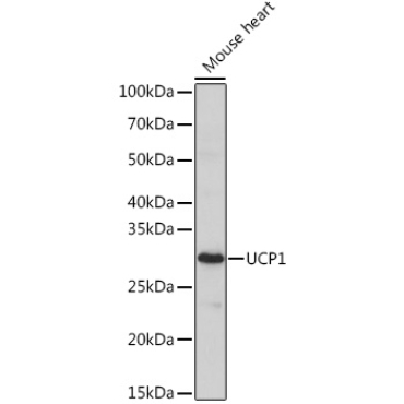 UCP1 Rabbit Polyclonal Antibody
