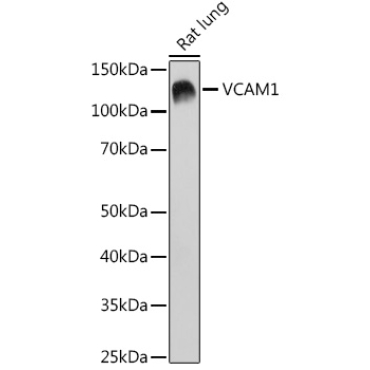 VCAM1 Rabbit Monoclonal Antibody