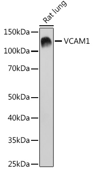 VCAM1 Rabbit Monoclonal Antibody