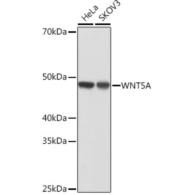 WNT5A Rabbit Monoclonal Antibody