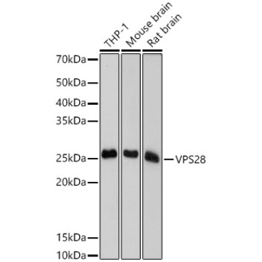 VPS28 Rabbit Monoclonal Antibody