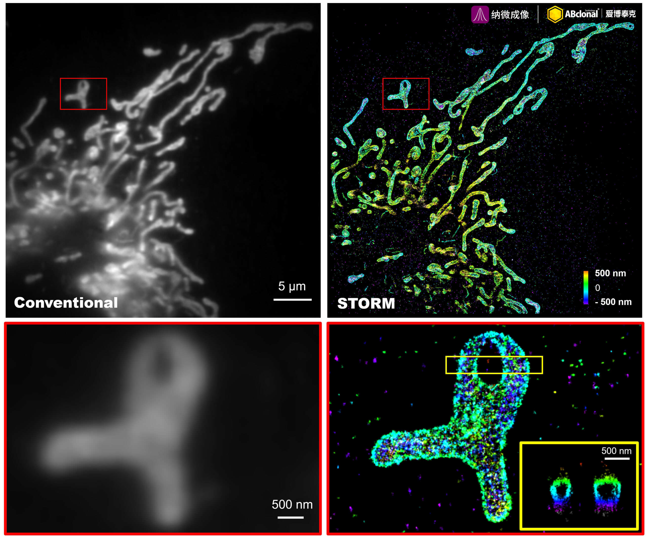TOM20 Rabbit Monoclonal Antibody