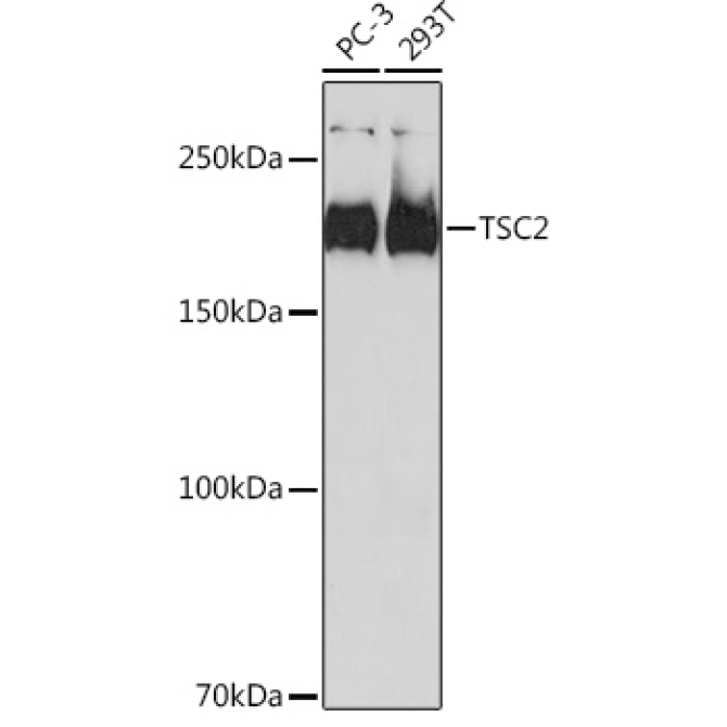 TSC2 Rabbit Monoclonal Antibody