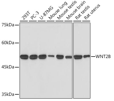 WNT2B Rabbit Monoclonal Antibody