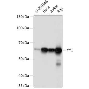 YY1 Rabbit Monoclonal Antibody
