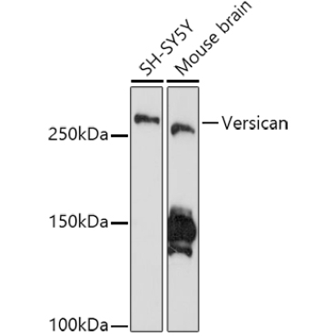 Versican Rabbit Monoclonal Antibody