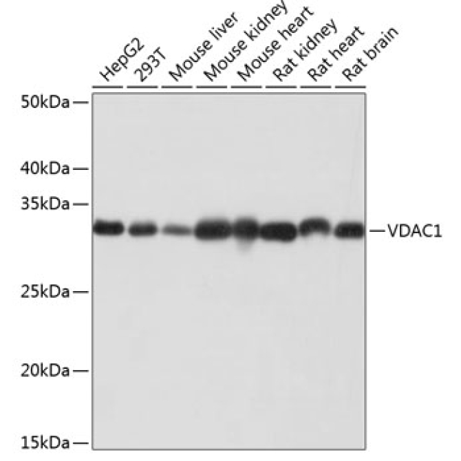 VDAC1 Rabbit Monoclonal Antibody