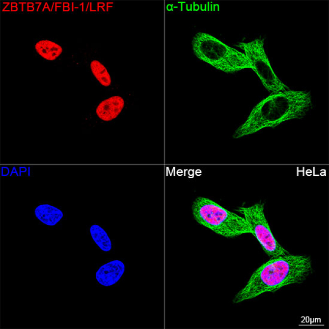 ZBTB7A/FBI-1/LRF Rabbit Monoclonal Antibody
