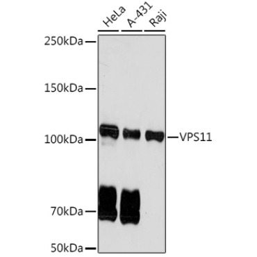 VPS11 Rabbit Monoclonal Antibody