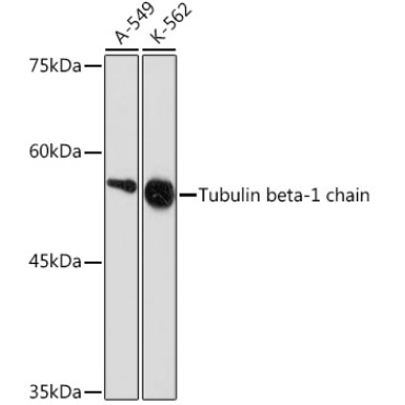 Tubulin beta-1 chain Rabbit Monoclonal Antibody
