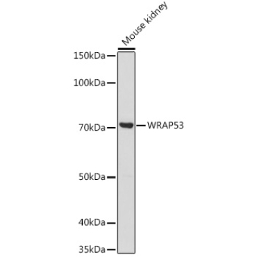 WRAP53 Rabbit Polyclonal Antibody