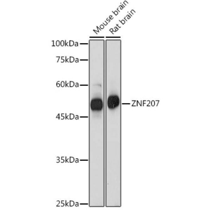 ZNF207 Rabbit Polyclonal Antibody