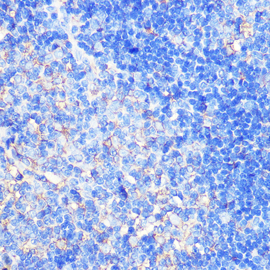 XCR1 Rabbit Polyclonal Antibody