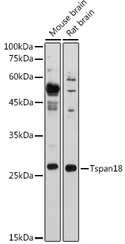 Tspan18 Rabbit Polyclonal Antibody