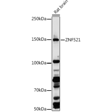 ZNF521 Rabbit Polyclonal Antibody