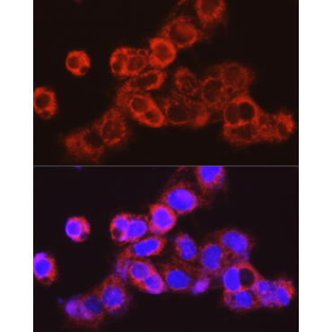 UGT2B17 Rabbit Polyclonal Antibody