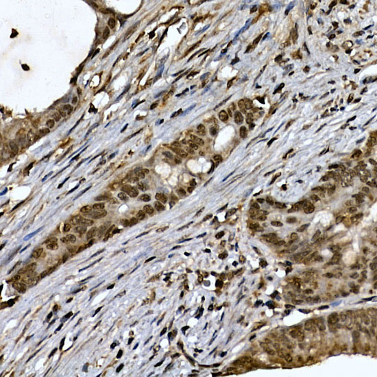 ZNF213 Rabbit Polyclonal Antibody