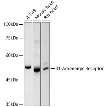 Beta1-Adrenergic Receptor Rabbit Polyclonal Antibody