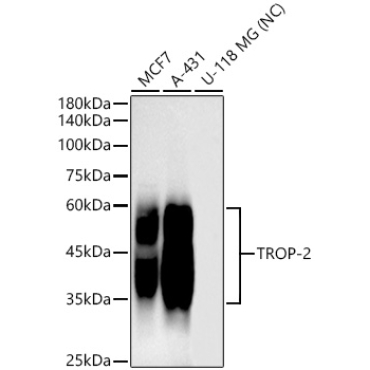 TROP-2 Rabbit Monoclonal Antibody