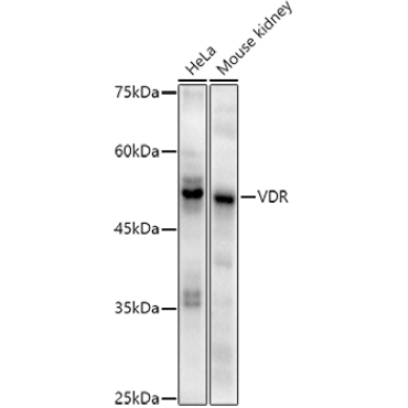 VDR Rabbit Monoclonal Antibody