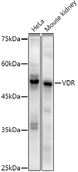 VDR Rabbit Monoclonal Antibody