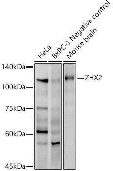 ZHX2 Rabbit Monoclonal Antibody