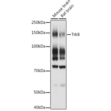 TrkB Rabbit Polyclonal Antibody