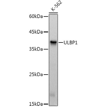 ULBP1 Rabbit Monoclonal Antibody