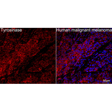 Tyrosinase Rabbit Monoclonal Antibody