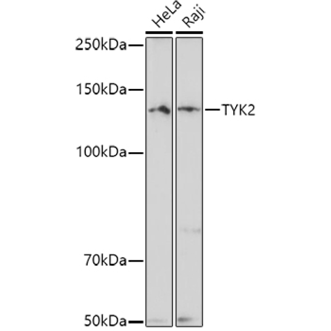TYK2 Rabbit Polyclonal Antibody
