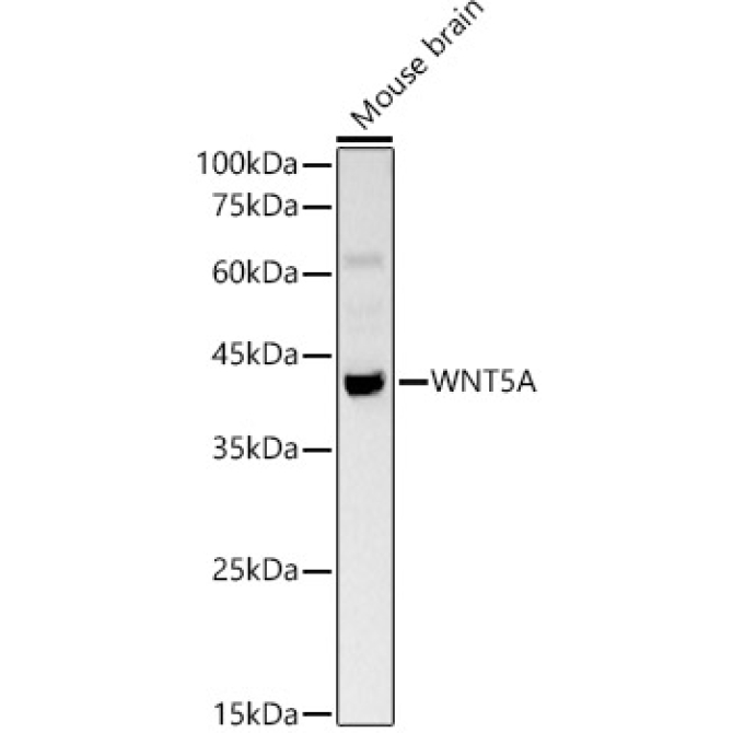 WNT5A Rabbit Polyclonal Antibody